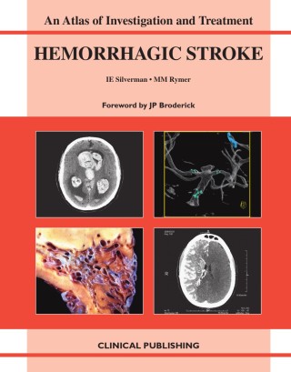 Hemorrhagic Stroke-An Atlas of Investigation and Treatment.pdf - 市场，金融 ...