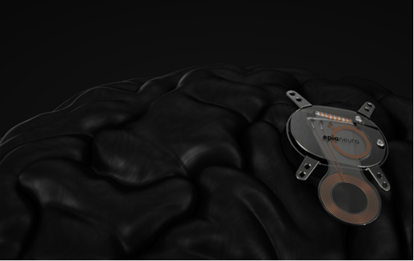 又一家脑机公司宣布成立，产品全面对标博睿康？