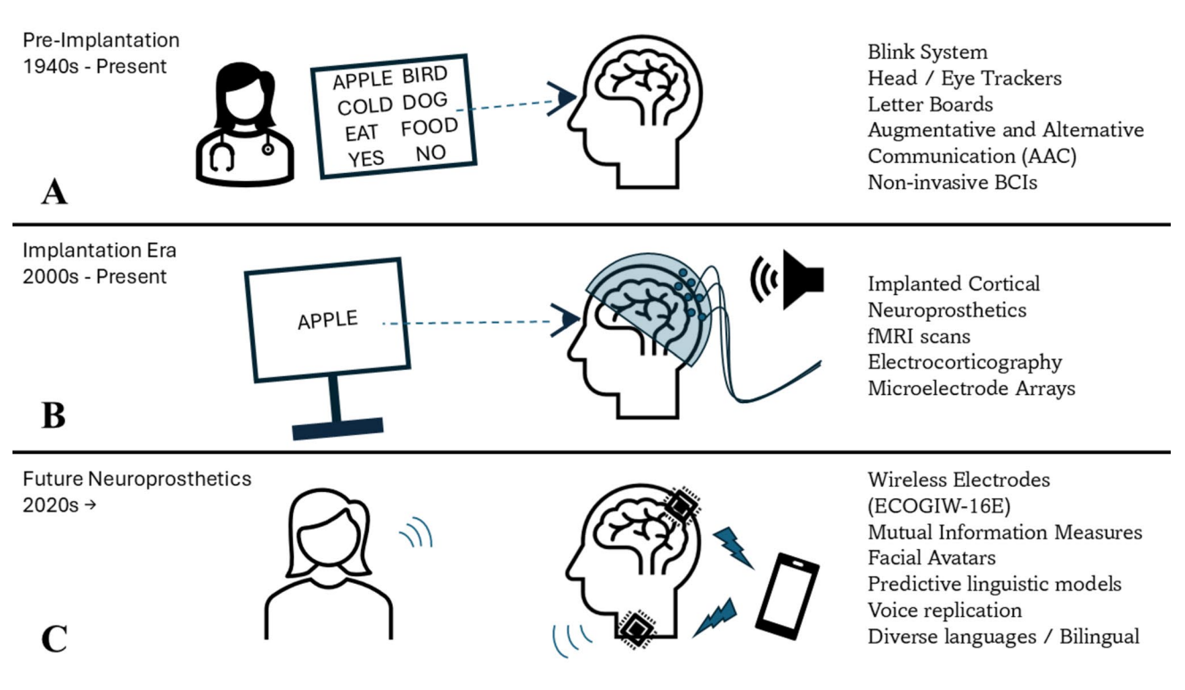 脑机接口能否帮助无构音患者重新开口？